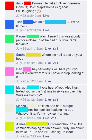 Man posts photo of a mysterious part of his body on Facebook, sending his friends into a spiral of confusion and horror.
